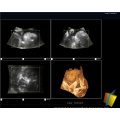 medical equipment 19" LCD monitor ultrasound scanner